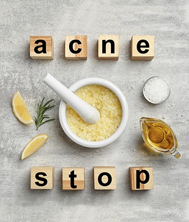 Struggling With Acne_Main